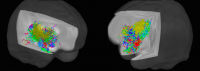 MRI-imaging-shows-white-matter-connections-in-infant-brains